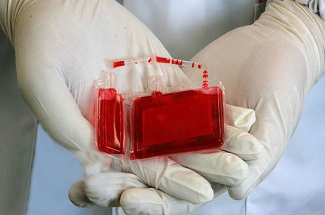 نگهداری ۱۸۰ هزار نمونه خون بندناف در کشور/ در درمان بیش از ۸۰ بیماری به کار می‌رود